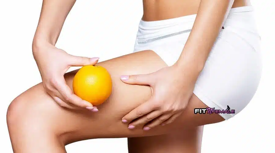 7 cose che dovresti sapere sulla cellulite