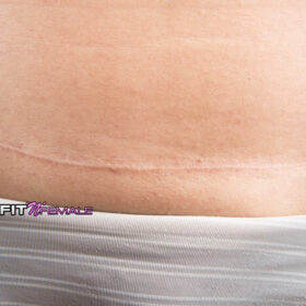 So startest du nach einem kaiserschnitt wieder mit dem training